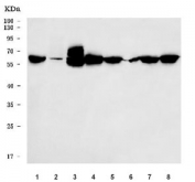 Western blot testing of 1)rat brain, 2) rat lung, 3) rat PC-12, 4) rat RH35, 5) mouse brain, 6) mouse lung, 7) mouse NIH 3T3 and 8) mouse HEPA1-6 cell lysate with TFEB antibody. Expected molecular weight: 53-60 kDa (unmodified), 65-70 kDa (modified).