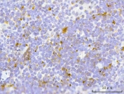 IHC staining of FFPE mouse spleen tissue with Transcription factor EB antibody. HIER: boil tissue sections in pH8 EDTA for 20 min and allow to cool before testing.