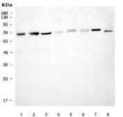 Western blot testing of 1) rat liver, 2) rat heart, 3) rat kidney, 4) rat RH35, 5) mouse liver, 6) mouse heart, 7) mouse kidney and 8) mouse NIH 3T3 cell lysate with USP22 antibody. Predicted molecular weight ~60 kDa.