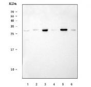 Western blot testing of 1) human Jurkat, 2) human placenta, 3) rat brain, 4) rat skeletal muscle, 5) mouse brain and 6) mouse skeletal muscle lysate with YWHAG antibody. Predicted molecular weight ~28 kDa.