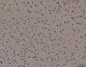 IHC staining of FFPE mouse brain tissue with CANX antibody. HIER: boil tissue sections in pH8 EDTA for 20 min and allow to cool before testing.