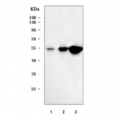 Western blot testing of human 1) A431, 2) T-47D and 3) 293T cell lysate with TP53 antibody. Expected molecular weight ~53 kDa.
