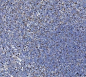IHC staining of FFPE human tonsil tissue with Interleukin 10 antibody. HIER: boil tissue sections in pH8 EDTA for 20 min and allow to cool before testing.