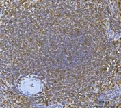 IHC staining of FFPE human spleen tissue with Interferon regulatory factor 7 antibody. HIER: boil tissue sections in pH8 EDTA for 20 min and allow to cool before testing.