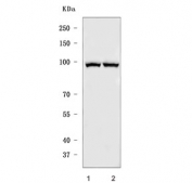 Western blot testing of human 1) HeLa and 2) HepG2 cell lysate with MARS1 antibody. Predicted molecular weight ~101 kDa.