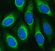 Flow cytometry testing of human SiHa cells with MARS1 antibody at 1ug/million cells (blocked with goat sera); Red=cells alone, Green=isotype control, Blue= MARS1 antibody.