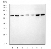 Western blot testing of 1) human HeLa, 2) human 293T, 3) human K562, 4) rat liver, 5) rat pancreas, 6) mouse liver and 7) mouse pancreas tissue lysate with Cystathionine Beta Synthase antibody. Predicted molecular weight ~61 kDa.