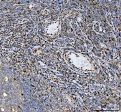 IHC staining of FFPE human tonsil tissue with Heat shock factor protein 1 antibody. HIER: boil tissue sections in pH8 EDTA for 20 min and allow to cool before testing.