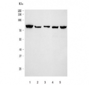 Western blot testing of human 1) HeLa, 2) K562, 3) MCF7, 4) MOLT4 and 5) 293T cell lysate with Heat shock factor protein 1 antibody. Predicted molecular weight ~57 kDa, observed molecular weight: 75-80 kDa.