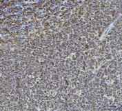 IHC staining of FFPE human tonsil tissue with Histone deacetylase 1 antibody. HIER: boil tissue sections in pH8 EDTA for 20 min and allow to cool before testing.