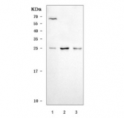 Western blot testing of human 1) 293T, 2) ThP-1 and 3) HL60 cell lysate with Growth factor receptor bound protein 2 antibody. Predicted molecular weight ~25 kDa.