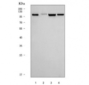 Western blot testing of human 1) SiHa, 2) U-2 OS, 3) HeLa and 4) U-251 cell lysate with Fibroblast activation protein alpha antibody. Predicted molecular weight: 88-95 kDa (monomer), ~170 kDa (homodimer).