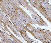 IHC staining of FFPE mouse heart tissue with ACO2 antibody. HIER: boil tissue sections in pH8 EDTA for 20 min and allow to cool before testing.
