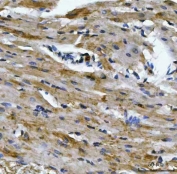 IHC staining of FFPE rat heart tissue with ACO2 antibody. HIER: boil tissue sections in pH8 EDTA for 20 min and allow to cool before testing.