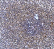 IHC staining of FFPE human spleen tissue with CAD Protein antibody. HIER: boil tissue sections in pH8 EDTA for 20 min and allow to cool before testing.