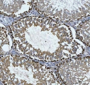 IHC staining of FFPE rat testis tissue with CAD Protein antibody. HIER: boil tissue sections in pH8 EDTA for 20 min and allow to cool before testing.