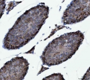 IHC staining of FFPE mouse testis tissue with CAD Protein antibody. HIER: boil tissue sections in pH8 EDTA for 20 min and allow to cool before testing.