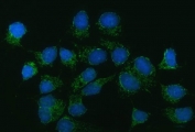 Immunofluorescent staining of FFPE human MCF7 cells with CAD Protein antibody (green) and DAPI nuclear stain (blue). HIER: steam section in pH6 citrate buffer for 20 min.