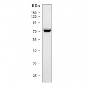 Western blot testing of human HepG2 cell lysate with Interleukin-1 receptor-like 1 antibody. Predicted molecular weight: 28-63 kDa (multiple isoforms).