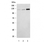 Western blot testing of human 1) K562, 2) U-251 and 3) MOLT4 cell lysate with EXO1 antibody. Expected molecular weight: 94-115 kDa.