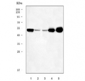 Western blot testing of 1) human HepG2, 2) human HeLa, 3) human MCF7, 4) rat liver and 5) mouse liver tissue lysate with PPAR alpha antibody. Predicted molecular weight ~52 kDa.