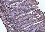 IHC staining of FFPE mouse colon tissue with TER ATPase antibody. HIER: boil tissue sections in pH8 EDTA for 20 min and allow to cool before testing.