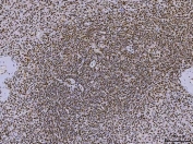 IHC staining of FFPE human spleen tissue with PC4 antibody. HIER: boil tissue sections in pH8 EDTA for 20 min and allow to cool before testing.
