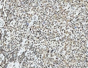 IHC staining of FFPE human testicular germ cell tumor tissue with PC4 antibody. HIER: boil tissue sections in pH8 EDTA for 20 min and allow to cool before testing.