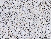 IHC staining of FFPE rat liver tissue with PC4 antibody. HIER: boil tissue sections in pH8 EDTA for 20 min and allow to cool before testing.