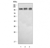 Western blot testing of human 1) Caco-2, 2) RT4 and 3) ThP-1 cell lysate with HMG CoA Reductase antibody. Predicted molecular weight ~97 kDa.