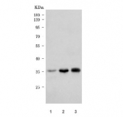 Western blot testing of human 1) U-2 OS, 2) U-251 and 3) SiHa cell lysate with NKX2.5 antibody. Predicted molecular weight ~35 kDa, routinely observed at 35~45 kDa.