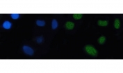 Immunofluorescent staining of FFPE human SiHa cells with NKX2.5 antibody (green) and DAPI nuclear stain (blue). HIER: steam section in pH6 citrate buffer for 20 min.