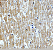 IHC staining of FFPE human heart tissue with NKX2.5 antibody, HRP-secondary and DAB substrate. HIER: boil tissue sections in pH8 EDTA for 20 min and allow to cool before testing.