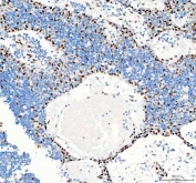 IHC staining of FFPE human spleen tissue with Glycogen synthase kinase-3 beta antibody. HIER: boil tissue sections in pH8 EDTA for 20 min and allow to cool before testing.