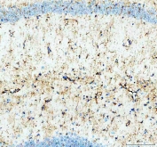 IHC staining of FFPE mouse brain tissue with Glycogen synthase kinase-3 beta antibody. HIER: boil tissue sections in pH8 EDTA for 20 min and allow to cool before testing.