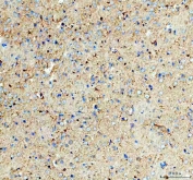 IHC staining of FFPE rat brain tissue with Glycogen synthase kinase-3 beta antibody. HIER: boil tissue sections in pH8 EDTA for 20 min and allow to cool before testing.