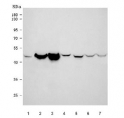 Western blot testing of 1) human HepG2, 2) human HCCT, 3) human HCCP, 4) rat liver, 5) rat RH35, 6) mouse liver and 7) mouse HEPA1-6 cell lysate with Epoxide hydrolase antibody. Predicted molecular weight ~53 kDa.