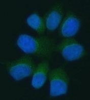 Immunofluorescent staining of FFPE human MCF7 cells with PANX1 antibody (green) and DAPI nuclear stain (blue). HIER: steam section in pH6 citrate buffer for 20 min.