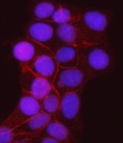 Immunofluorescent staining of FFPE human MCF7 cells with JUP antibody (red) and DAPI nuclear stain (blue). HIER: steam section in pH6 citrate buffer for 20 min.