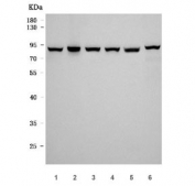 Western blot testing of 1) human HeLa, 2) human A431, 3) human A549, 4) human MCF7, 5) rat heart and 6) mouse heart tissue lysate with JUP antibody. Expected molecular weight: ~86 kDa.