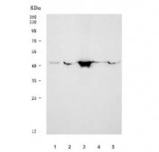 Western blot testing of 1) human U-87 MG, 2) rat liver, 3) rat RH35, 4) mouse lung and 5) mouse liver tissue lysate with YKL-40 antibody. Predicted molecular weight ~43 kDa.