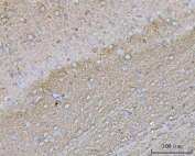 IHC staining of FFPE mouse brain tissue with YWHAE antibody. HIER: boil tissue sections in pH8 EDTA for 20 min and allow to cool before testing.
