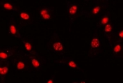 Immunofluorescent staining of FFPE human U-87 MG cells with TCF-8 antibody. HIER: steam section in pH6 citrate buffer for 20 min.