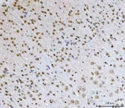IHC staining of FFPE mouse brain tissue with TCF-8 antibody. HIER: boil tissue sections in pH8 EDTA for 20 min and allow to cool before testing.