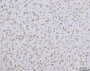 IHC staining of FFPE rat brain tissue with TCF-8 antibody. HIER: boil tissue sections in pH8 EDTA for 20 min and allow to cool before testing.