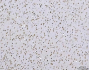 IHC staining of FFPE rat brain tissue with TCF-8 antibody. HIER: boil tissue sections in pH8 EDTA for 20 min and allow to cool before testing.