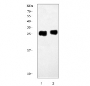 Western blot testing of 1) rat heart and 2) mouse heart tissue lysate with Troponin I antibody. Expected molecular weight: 24-28 kDa.