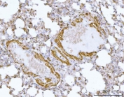 IHC staining of FFPE mouse lung tissue with HBEGF antibody. HIER: boil tissue sections in pH8 EDTA for 20 min and allow to cool before testing.
