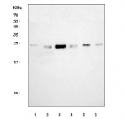 Western blot testing of 1) human HeLa, 2) human K562, 3) human Jurkat, 4) human U-251, 5) rat C6 and 6) mouse lung tissue lysate with HBEGF antibody. Predicted molecular weight ~23 kDa.