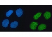Immunofluorescent staining of FFPE human U-2 OS cells with hnRNP K antibody (green) and DAPI nuclear stain (blue). HIER: steam section in pH6 citrate buffer for 20 min.